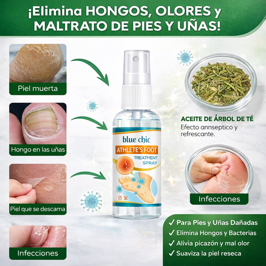 Micostop Spray Antifúngico Natural – Pies, Manos y Articulaciones oregano