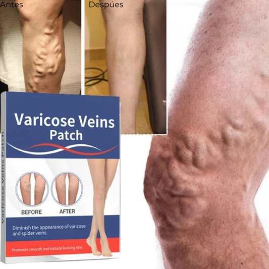 PARCHE MEDICINAL PARA VARICES
