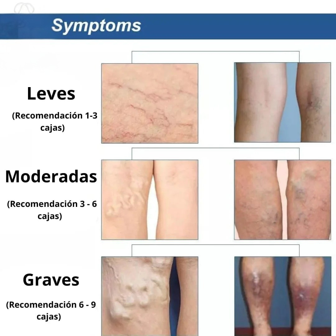 PARCHE MEDICINAL PARA VARICES