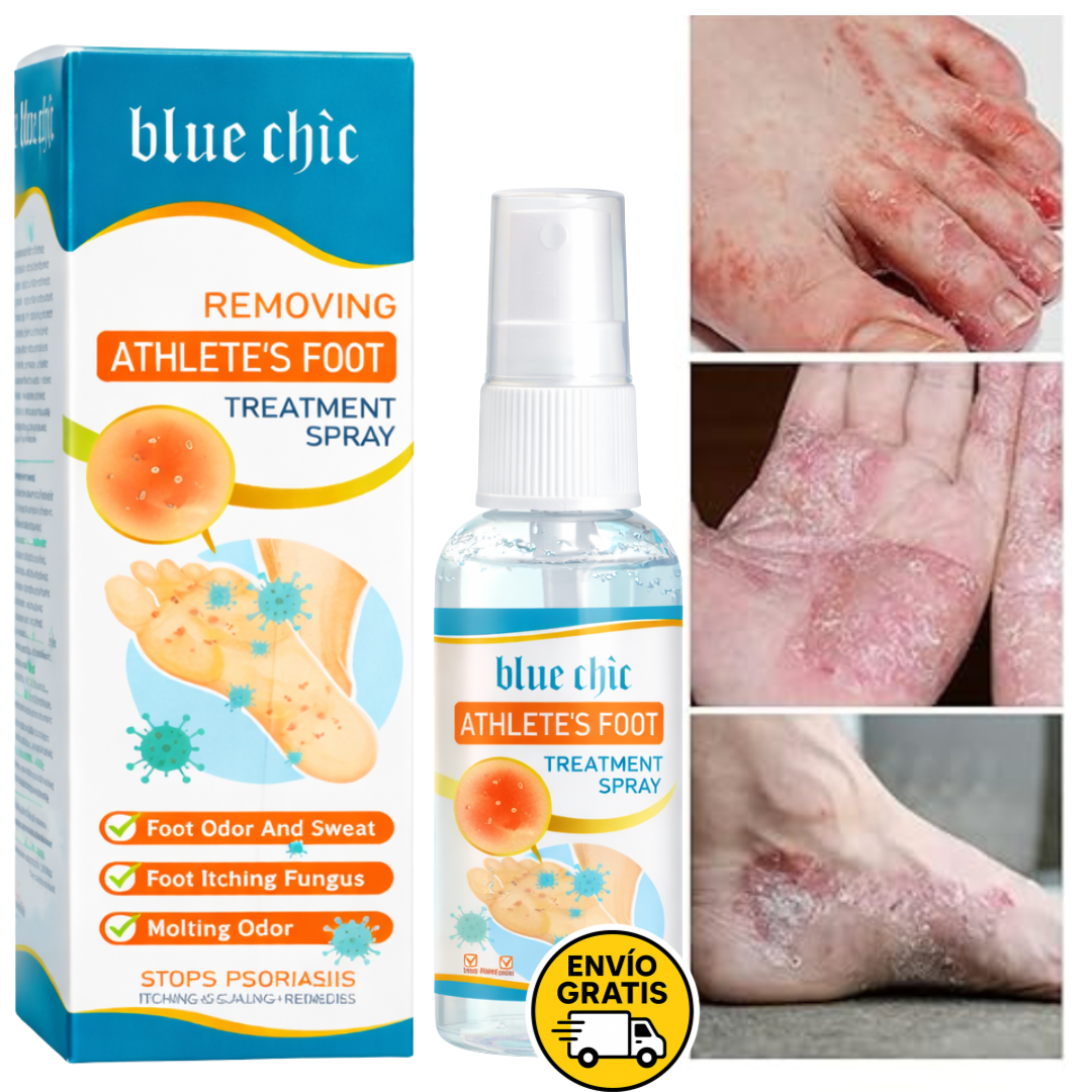 Micostop Spray Antifúngico Natural – Pies, Manos y Articulaciones oregano