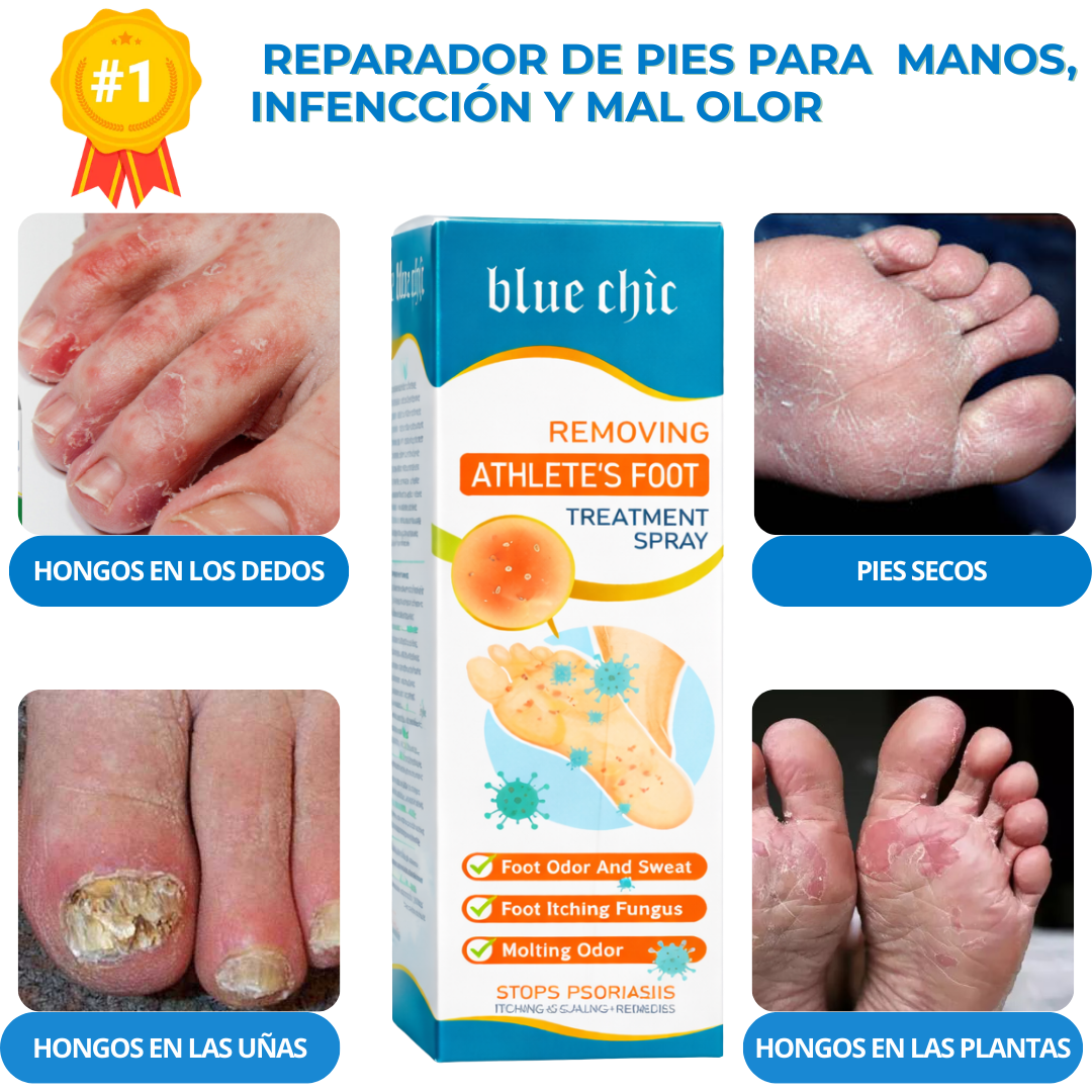 Micostop Spray Antifúngico Natural – Pies, Manos y Articulaciones oregano