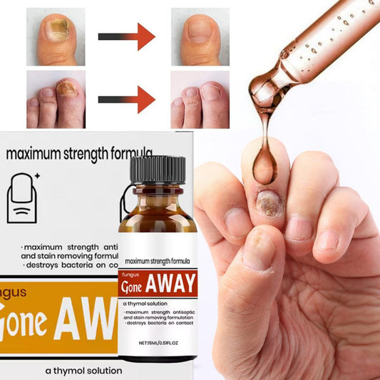 Removedor Hongos y reparador Avanzado de Uñas