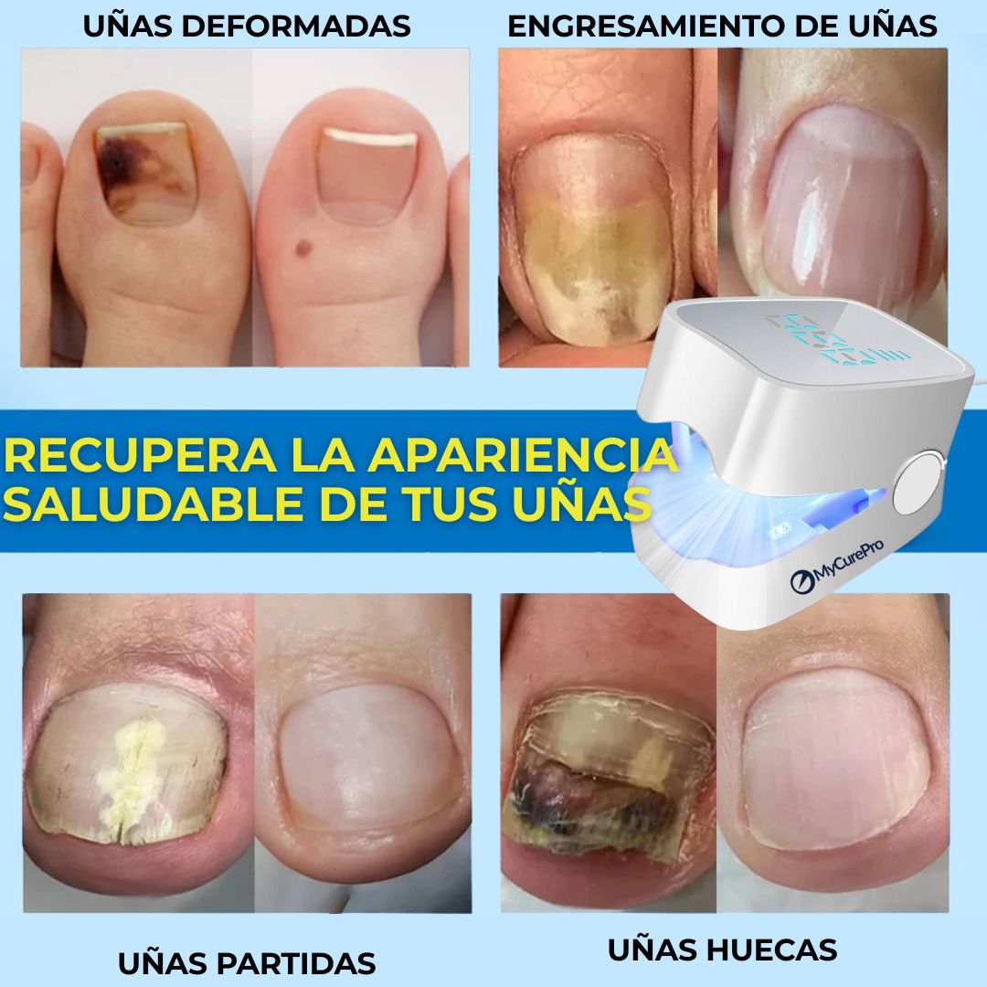 Revitalización avanzada antihongos